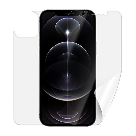 Screenshield APPLE iPhone 12 Pro folie na celé tělo