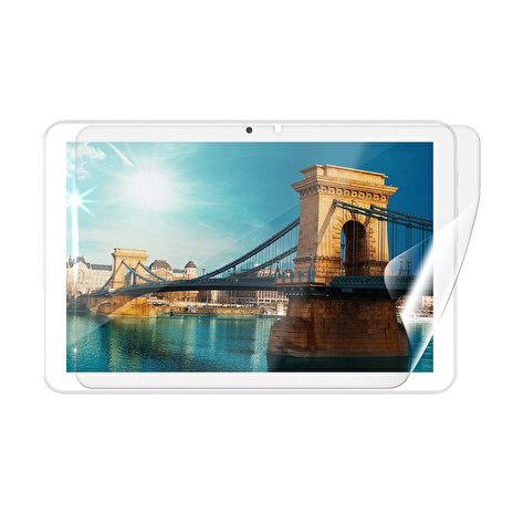 Screenshield IGET Smart W201 fólie na displej