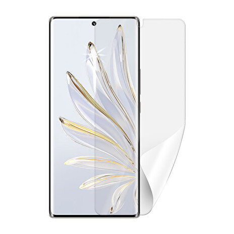 Screenshield HUAWEI Honor 70 fólie na displej